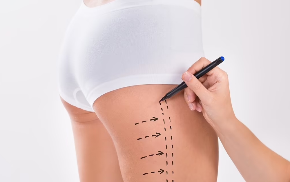 Principais razões para considerar Lisboa para o seu procedimento de lipoaspiração